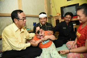 Dedi Mulyadi Upayakan Kesembuhan Anak Tanpa Tempurung Kepala asal Ciamis