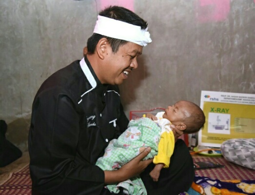 Golkar Jawa Barat Tanggung Pengobatan Rizky, Bayi Asal Cianjur Penderita Hirschsprung Disease