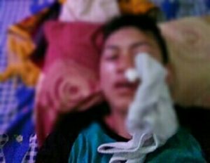Tiba-Tiba Ahcmad Fauzi Dipukuli Tengah Jalan