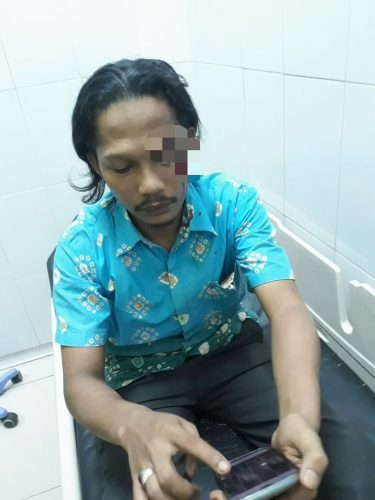 Kades Jatimekar Terluka Akibat Bogem Oknum Bamusdes