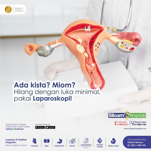 Laparoskopi Ginekologi di Siloam Hospitals Purwakarta, Tindakan Bedah Minim Sayatan untuk Kandungan